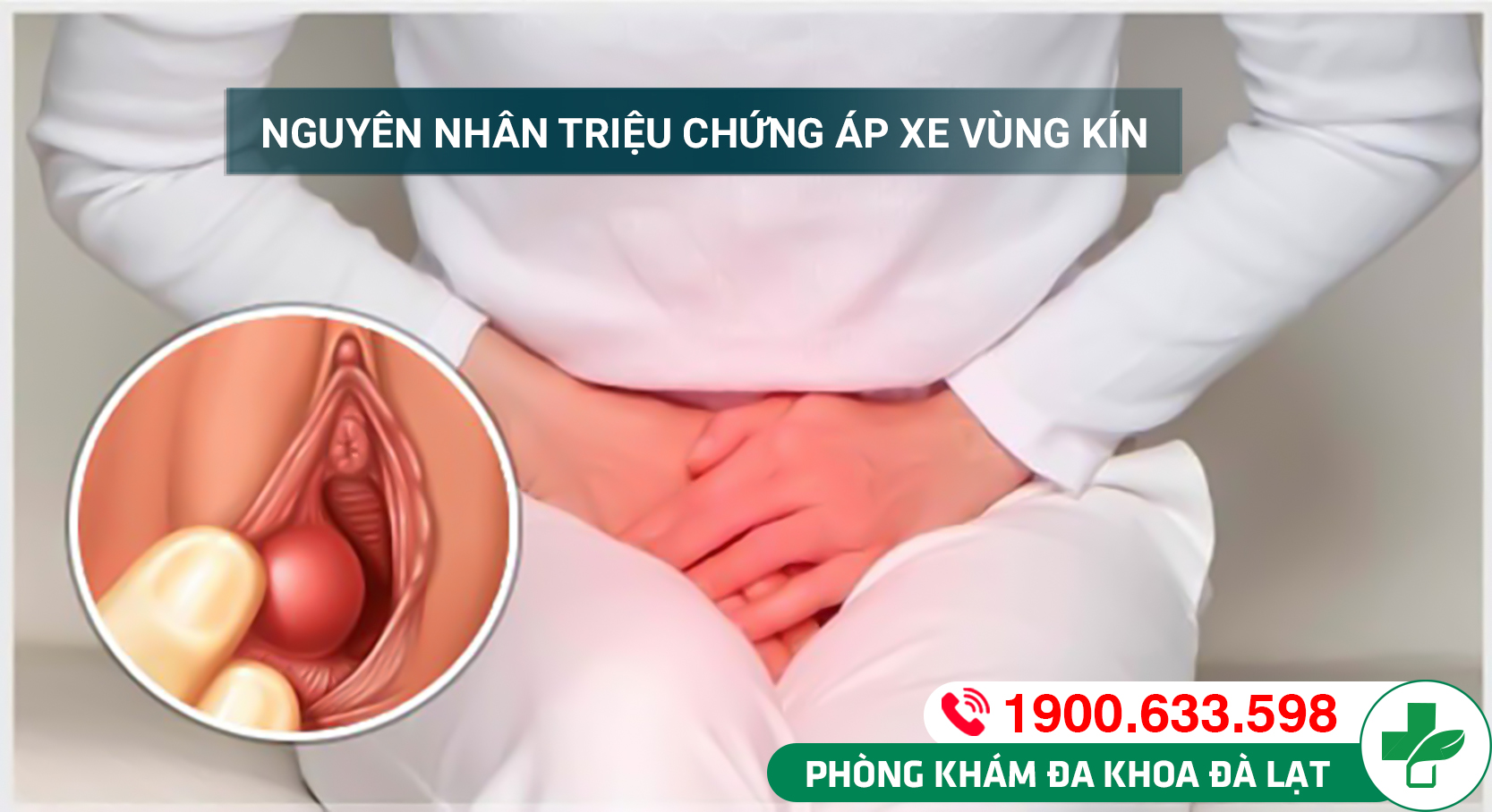 Hình ảnh minh họa